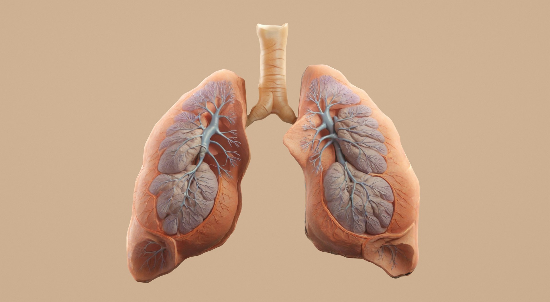 emfisema